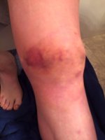 Knee2.jpg